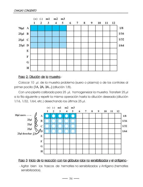 Chagas congÃ©nito - Prenatal