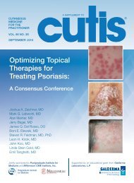 Optimizing Topical Therapies for Treating Psoriasis: