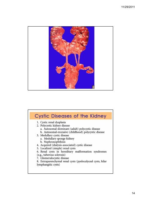 ระบบขับถายปสสาวะ (Kidney and Urinary ... - มหาวิทยาลัยนเรศวร