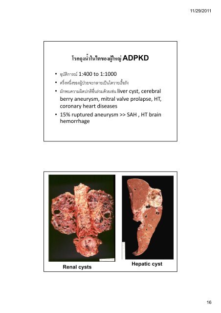 ระบบขับถายปสสาวะ (Kidney and Urinary ... - มหาวิทยาลัยนเรศวร