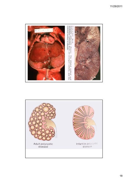 ระบบขับถายปสสาวะ (Kidney and Urinary ... - มหาวิทยาลัยนเรศวร