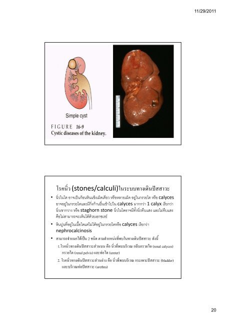 ระบบขับถายปสสาวะ (Kidney and Urinary ... - มหาวิทยาลัยนเรศวร