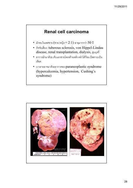 ระบบขับถายปสสาวะ (Kidney and Urinary ... - มหาวิทยาลัยนเรศวร