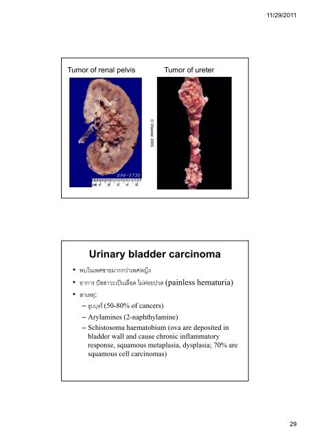 ระบบขับถายปสสาวะ (Kidney and Urinary ... - มหาวิทยาลัยนเรศวร