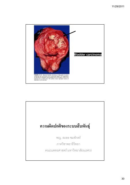 ระบบขับถายปสสาวะ (Kidney and Urinary ... - มหาวิทยาลัยนเรศวร