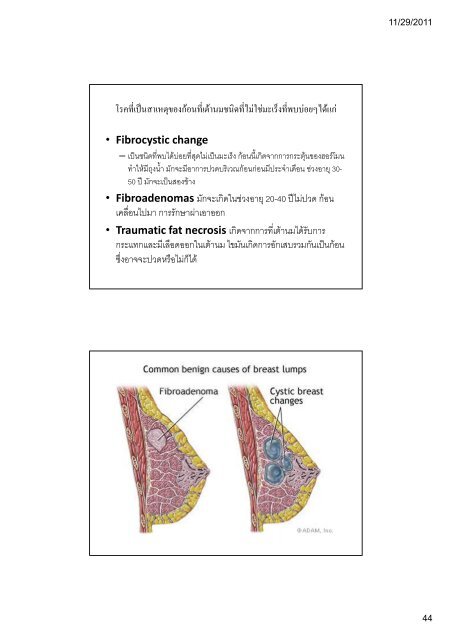 ระบบขับถายปสสาวะ (Kidney and Urinary ... - มหาวิทยาลัยนเรศวร