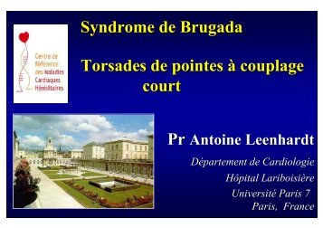 Syndrome de Brugada Torsades de pointes Ã  couplage court