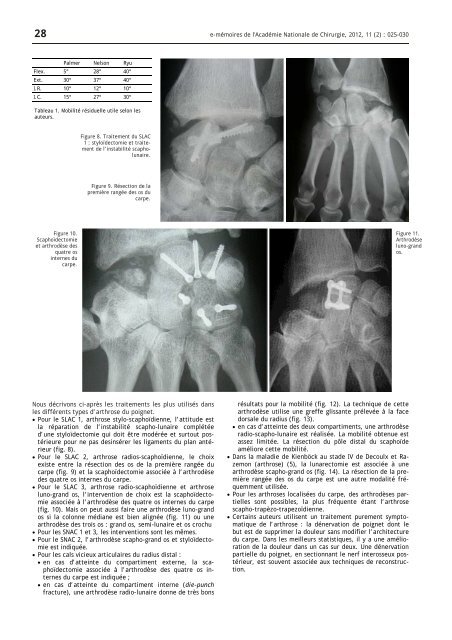 Evolution et traitement de l'arthrose du poignet - AcadÃ©mie ...