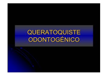 QUERATOQUISTE ODONTOGÉNICO [Sólo lectura]