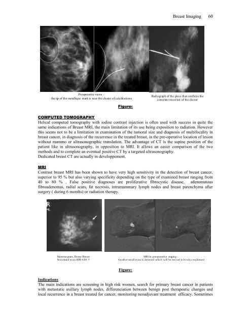 Breast Cancer - Arab Medical Association Against Cancer