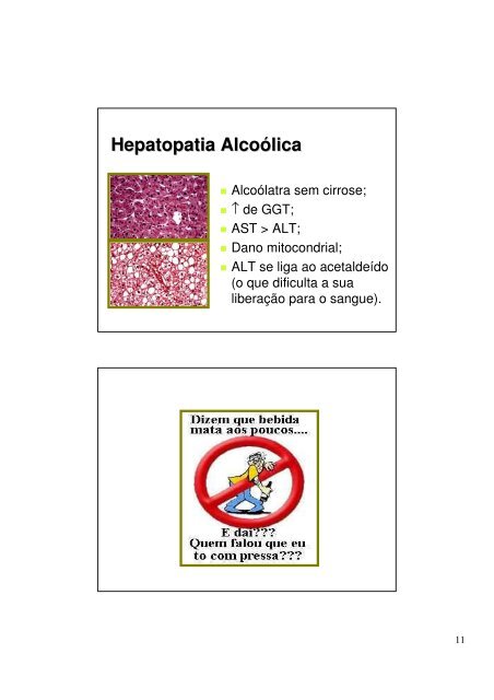 Enzimas Hepaticas.pdf - Ucg