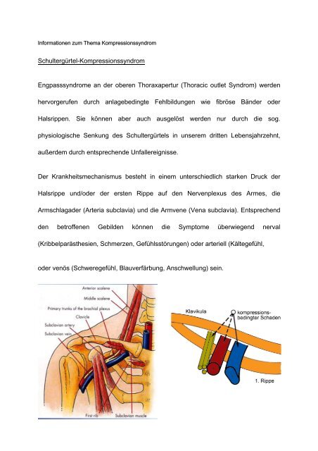 Schultergürtel-Kompressionssyndrom Engpasssyndrome an der ...