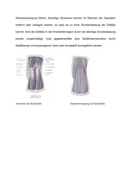 Schultergürtel-Kompressionssyndrom Engpasssyndrome an der ...