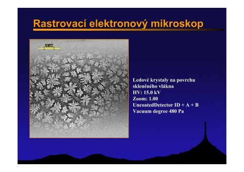 Elektronový mikroskop