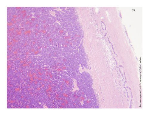 Pheochromocytoma Presentation.pptx - University of Georgia ...