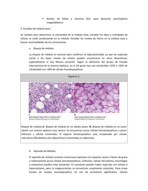 Anemia AplÃ¡sica - Telmeds.org