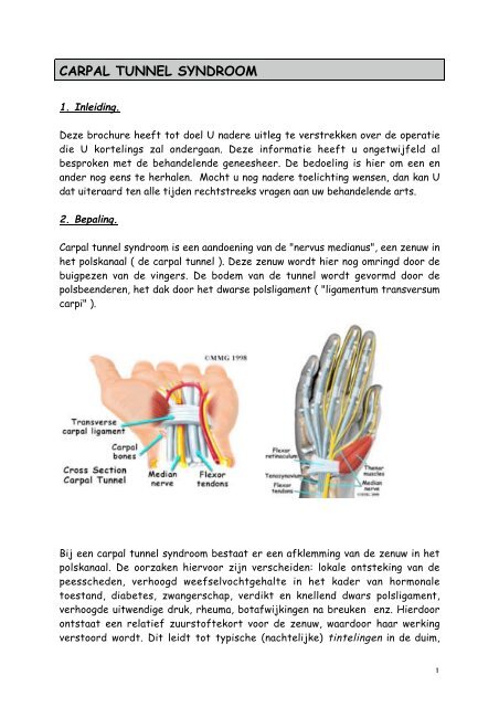 carpal tunnel syndroom - Orthopedie Stedelijk Ziekenhuis Roeselare