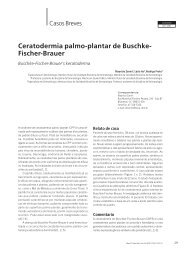 Ceratodermia palmo-plantar de Buschke-Fischer ... - edigraphic.com