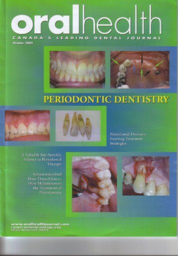 Periodontal Diseases - Oral Science | Creating the Synergy