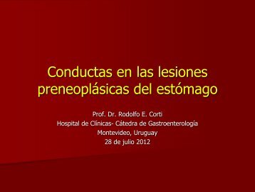 Conductas en las lesiones preneoplÃ¡sicas del estÃ³mago