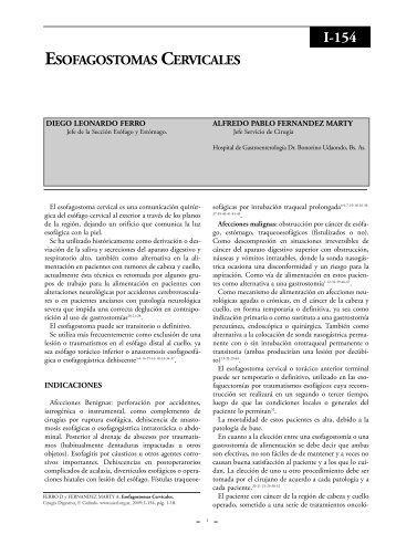 Esofagostomas cervicales. - sacd.org.ar