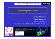 Neuroimagen Funcional - UPV