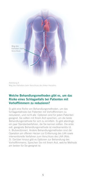 Patientenleitfaden fÃ¼r den Interventionellen ... - St. Jude Medical