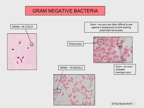 (ALMOST) ALL THE BACTERIOLOGY YOU NEED TO KNOW