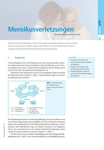 Meniskusverletzungen - FOMT