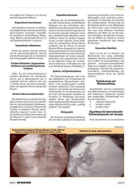 Belastungs-Angina pectoris