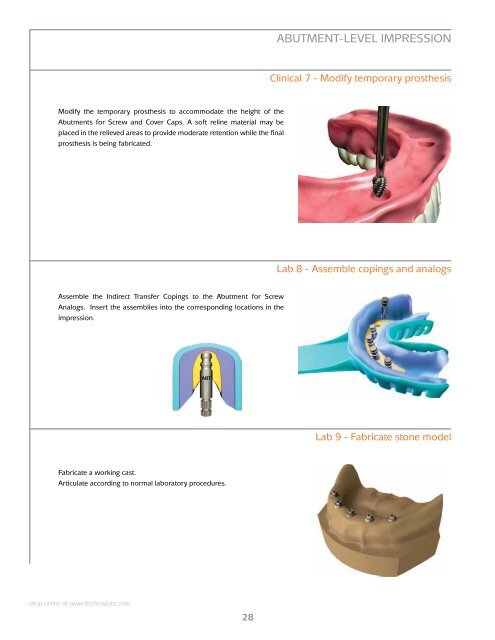 Internal Prosthetic Manual - BioHorizons