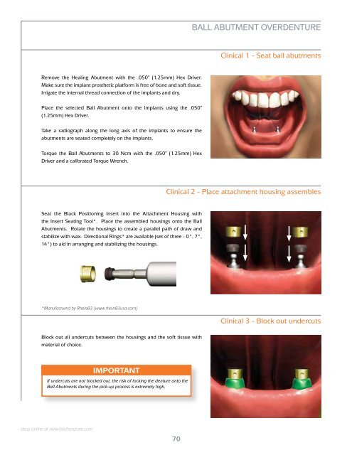 Internal Prosthetic Manual - BioHorizons