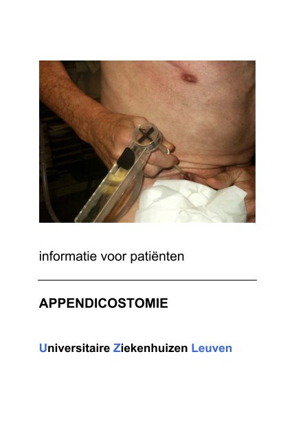 informatie voor patiÃ«nten APPENDICOSTOMIE - UZ Leuven