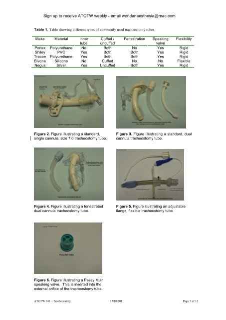 TRACHEOSTOMY ANAESTHESIA TUTORIAL OF ... - Anaesthesia UK