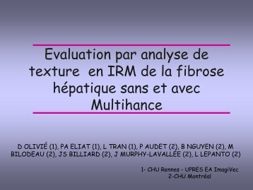 Evaluation par analyse de texture en IRM de la fibrose hÃ©patique ...