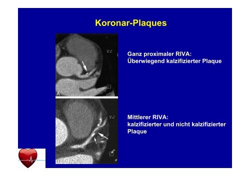 Stellenwert des Cardio-CT in der ambulanten ... - Ww-kardio-do.de