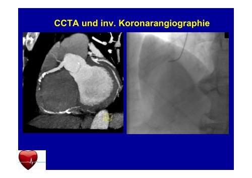 Stellenwert des Cardio-CT in der ambulanten ... - Ww-kardio-do.de