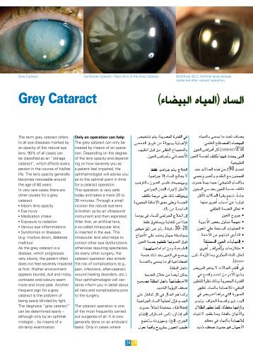 "Grey Cataract" German Medical Journal (english/arabic)