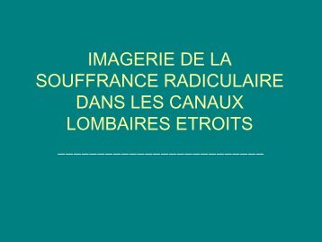 imagerie de la souffrance radiculaire dans les canaux lombaires ...