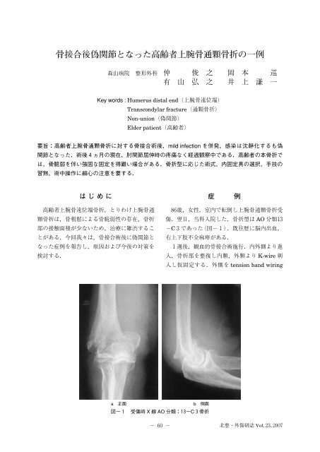骨接合後偽関節となった高齢者上腕骨通顆骨折の