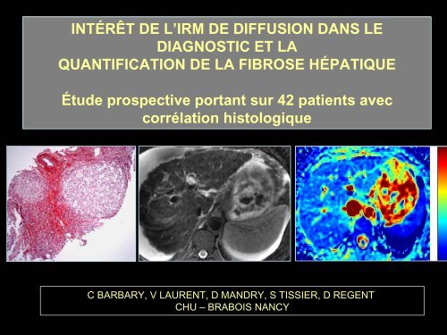 L'hÃ©patopathie chronique fibrosante