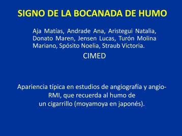 SIGNO DE LA BOCANADA DE HUMO - Congreso SORDIC