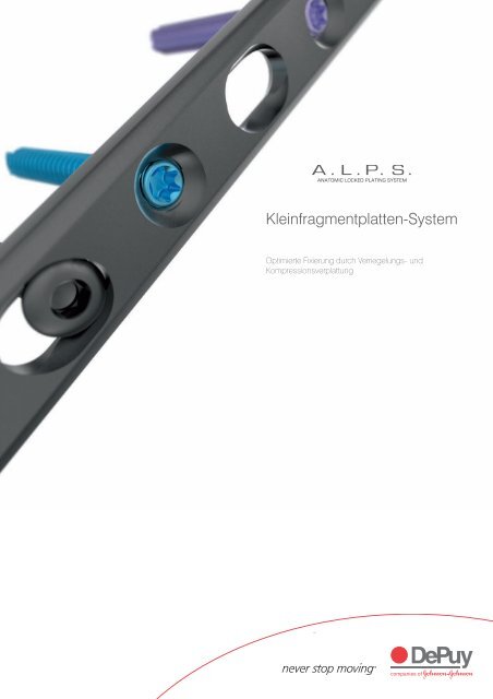 Kleinfragmentplatten-System - Biomet