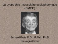 La dystrophie musculaire oculopharyngÃ©e (DMOP)