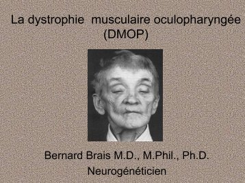 La dystrophie musculaire oculopharyngÃ©e (DMOP)