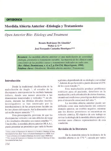 Mordida.Abierta Anterior -EtiologÃ­a y Tratamiento