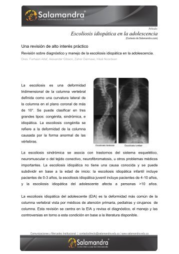 Escoliosis idiopÃ¡tica en la adolescencia - Salamandra