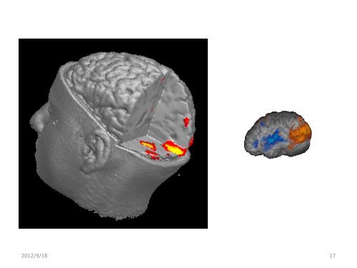 Contemporary Cognitive Neuroscience: Brain and Mind