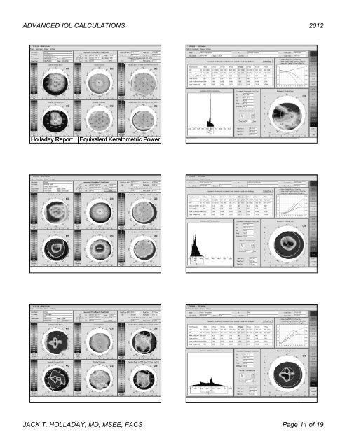 ADVANCED IOL POWER CALCULATIONS Jack T ... - ascrs 2012