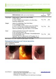 Endoskopische Submukosadissektion im Magen-Darmtrakt